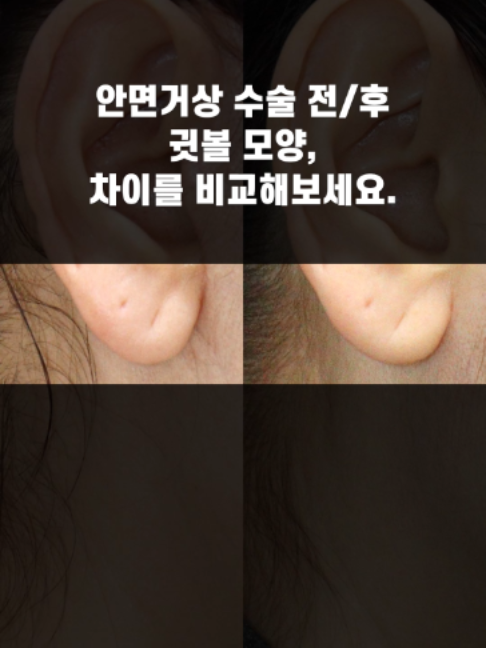 @다시피움성형외과 DASIPIUM タシピウム