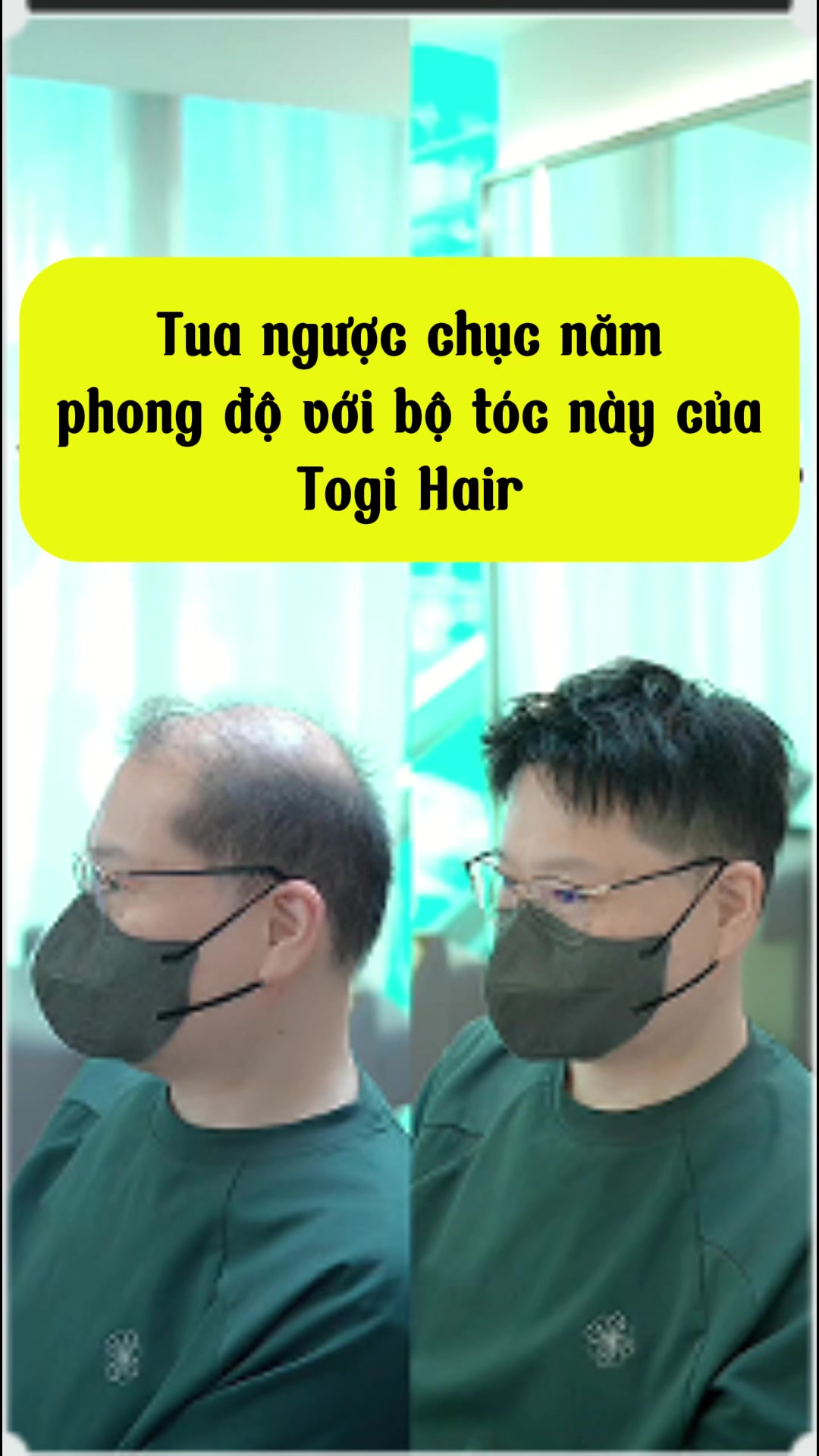 @Thái Sơn Tóc Giả