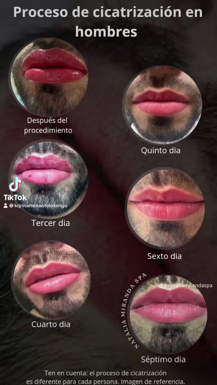@lucete.ve