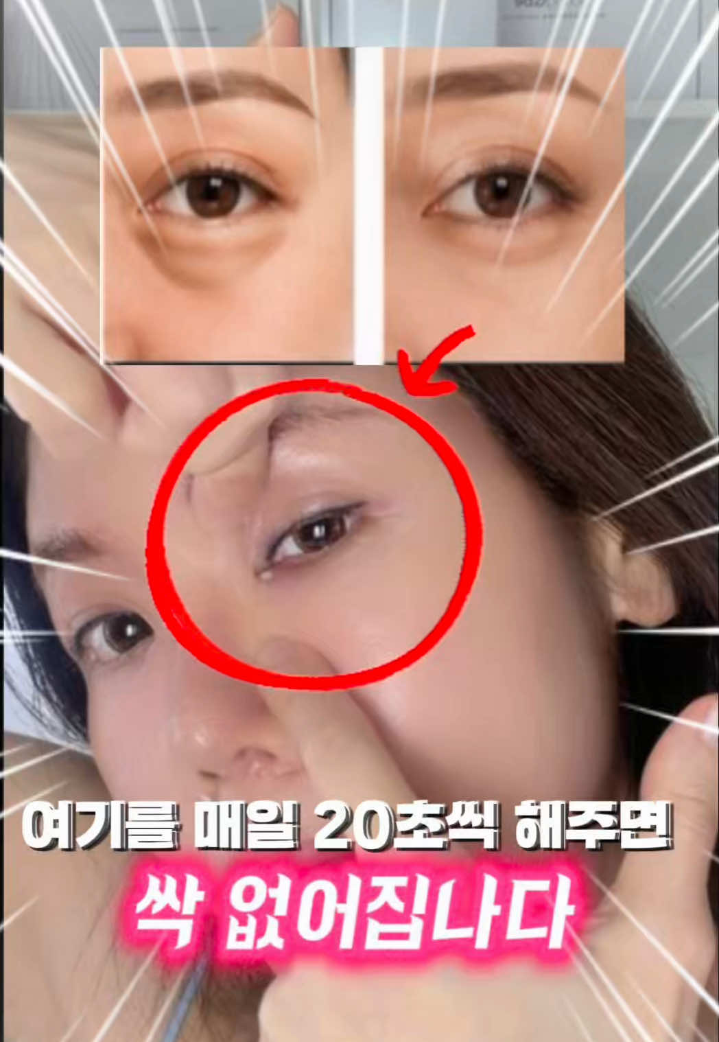 @지나스 GINAS