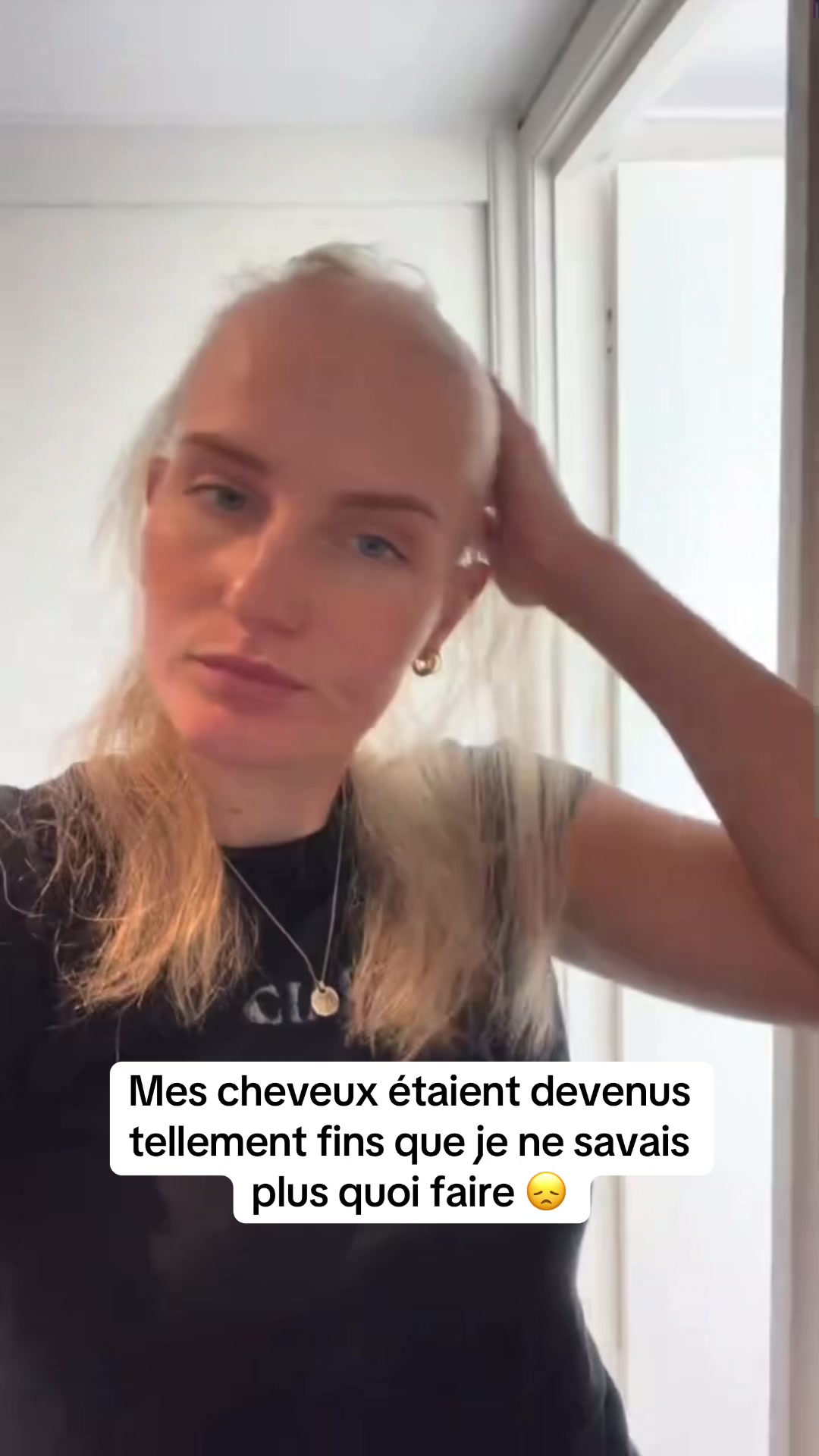 @Lux’Hair Growth