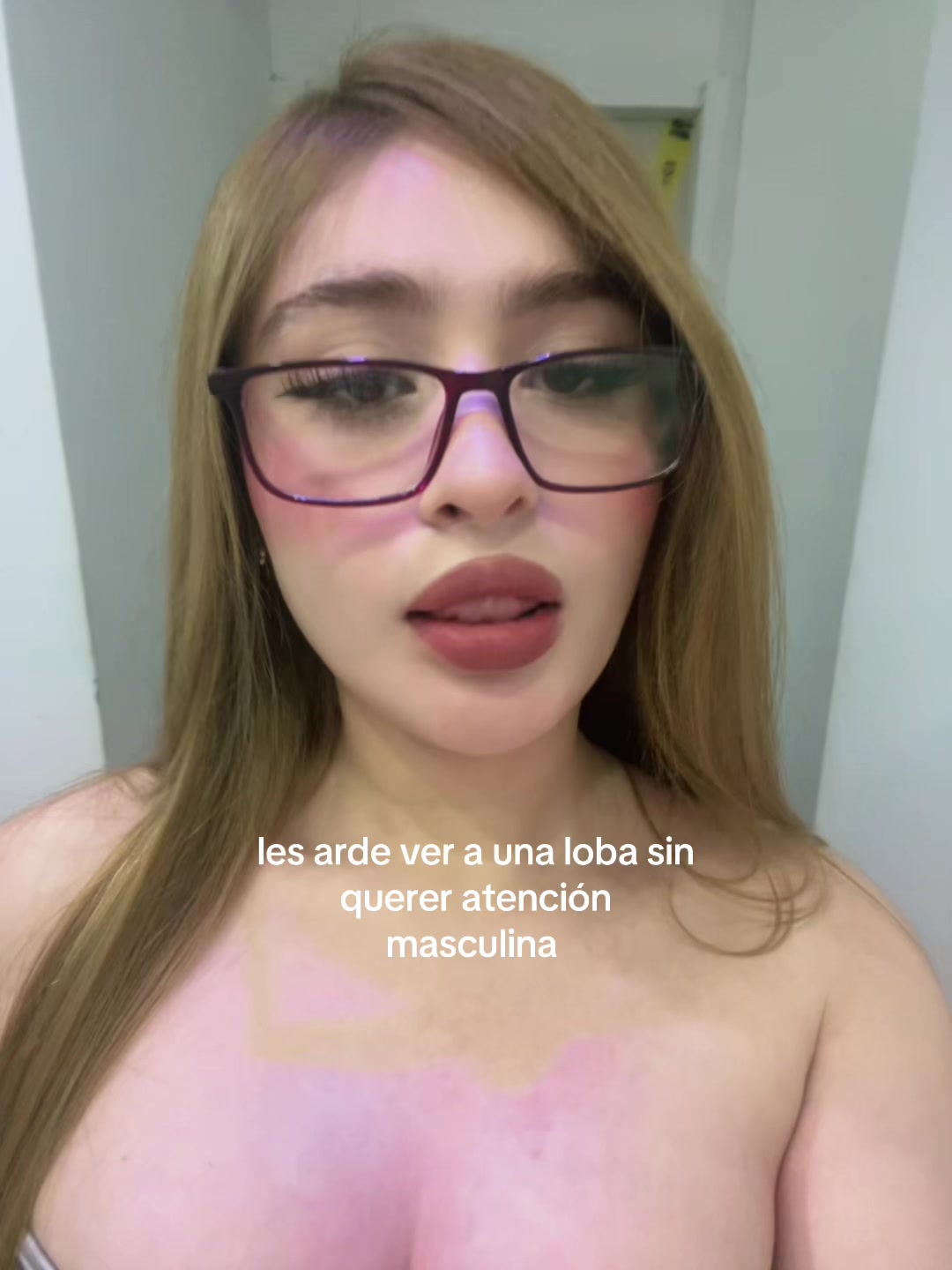 @Ale rod