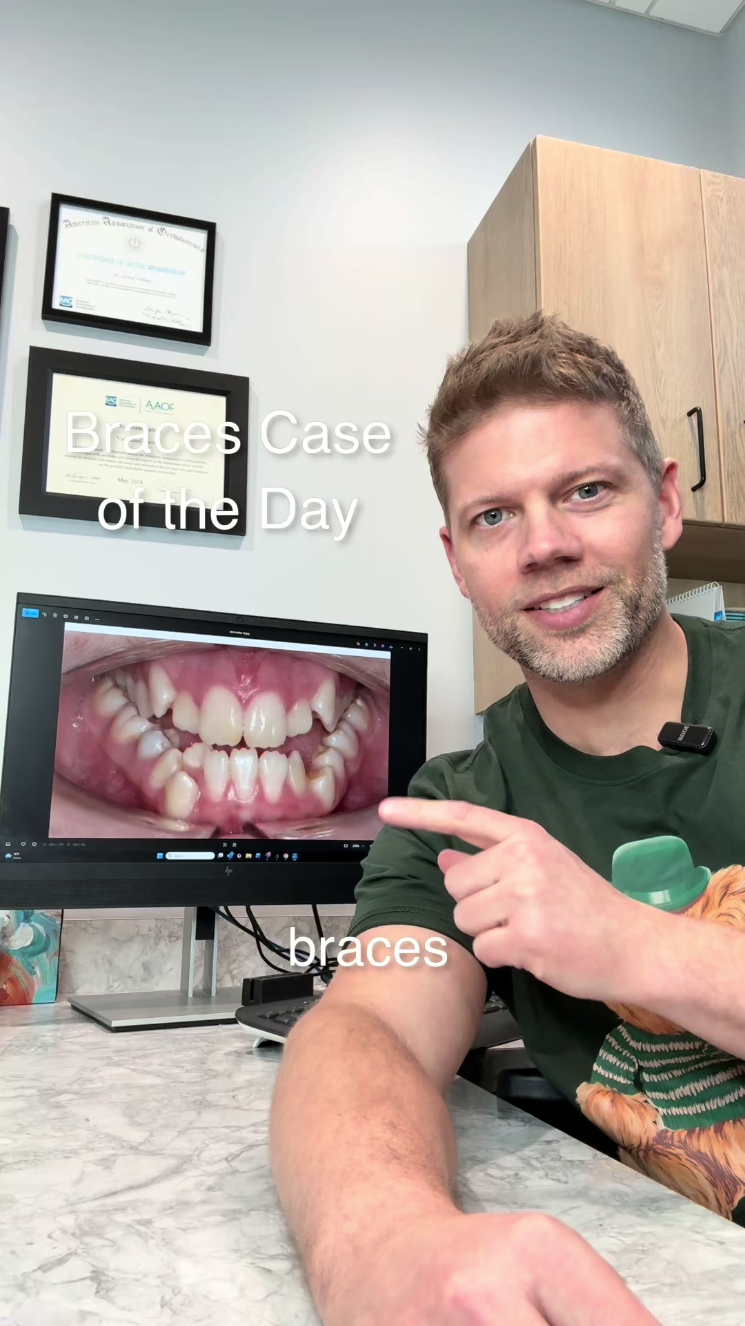 @The Braces Guy