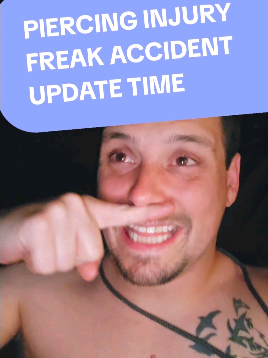 @RareOrion