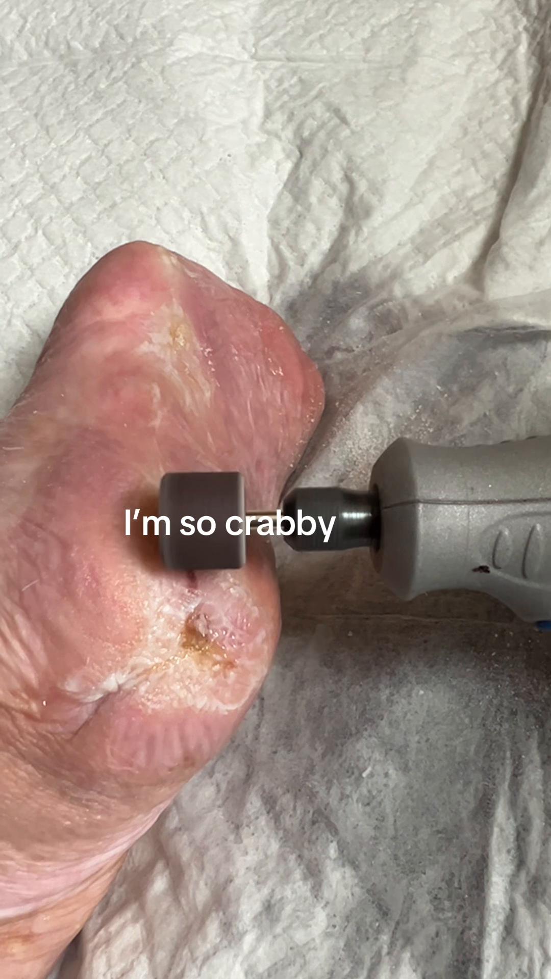 @SillyBlueSnow