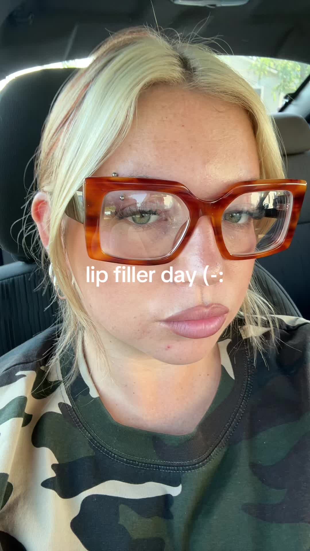 @onlygirlinthaworldd
