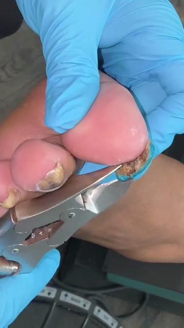 @Deniel Foot and Ankle Center