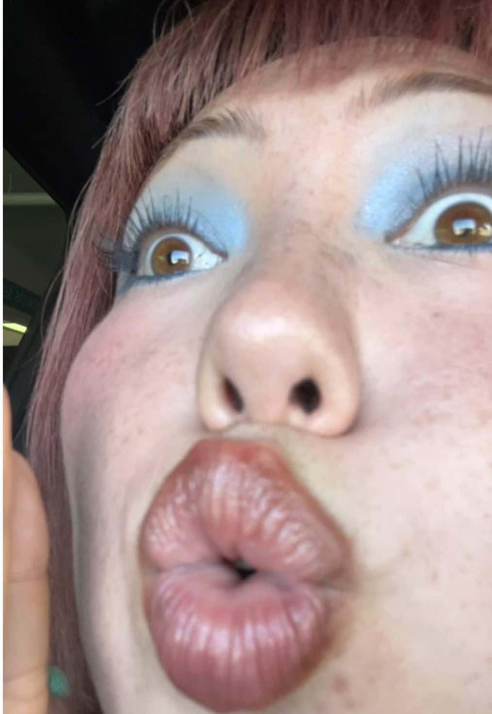 @allyson