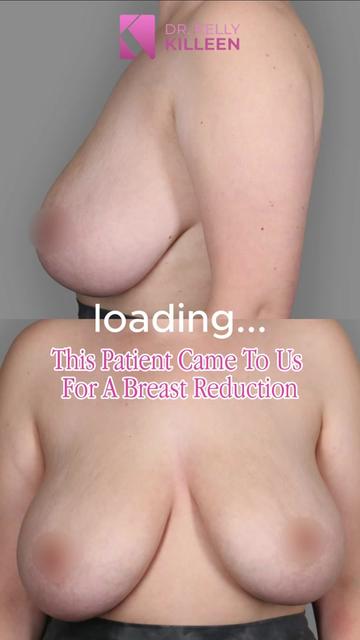 @Kelly&ensp;Killeen,&ensp;MD,&ensp;FACS