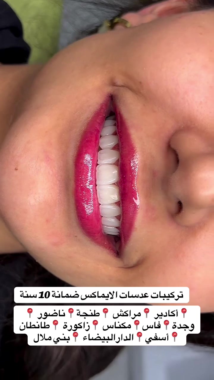 @brightsmileee1