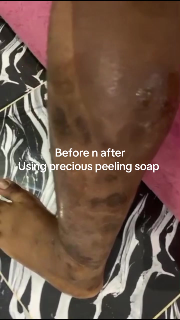 @@ Precious peeling soap