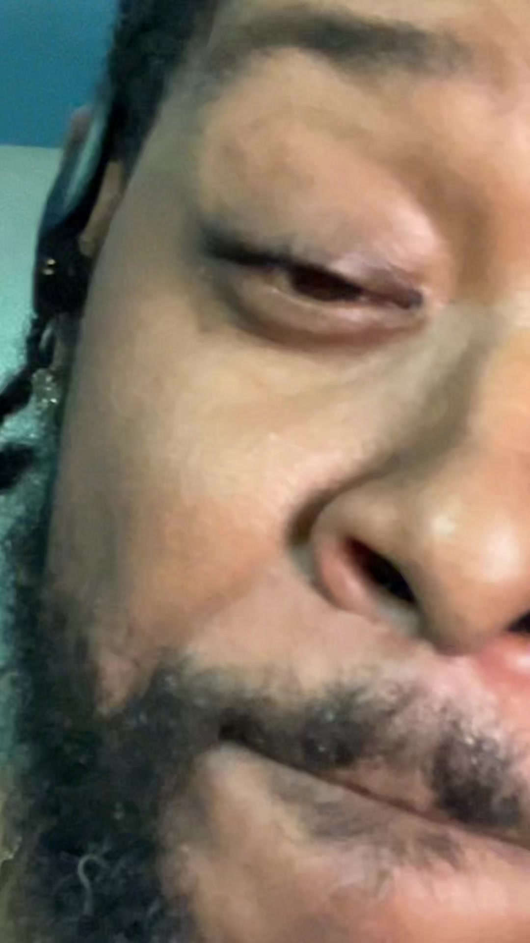 @Skalla Vision