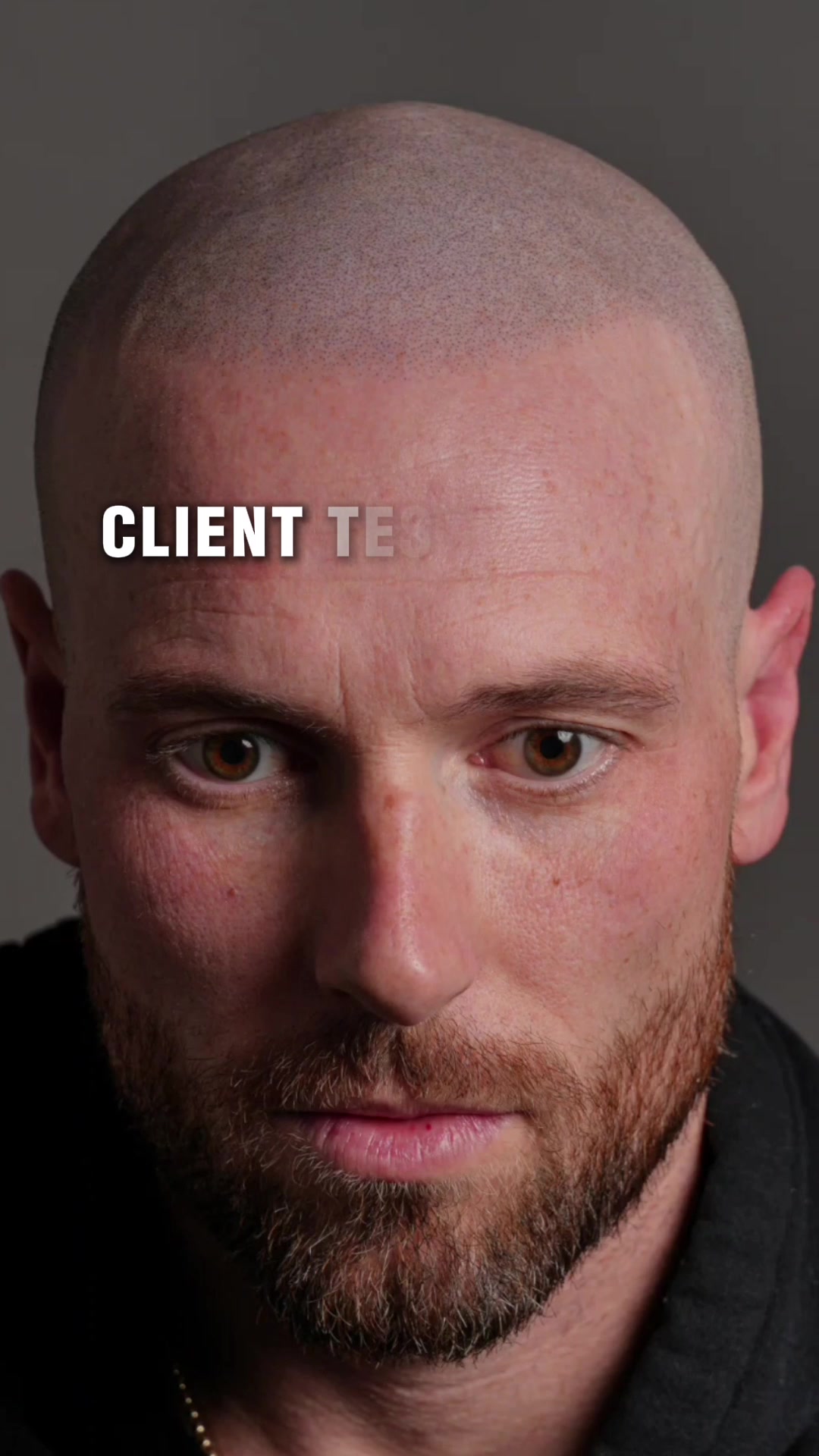 @Enhanced Scalp