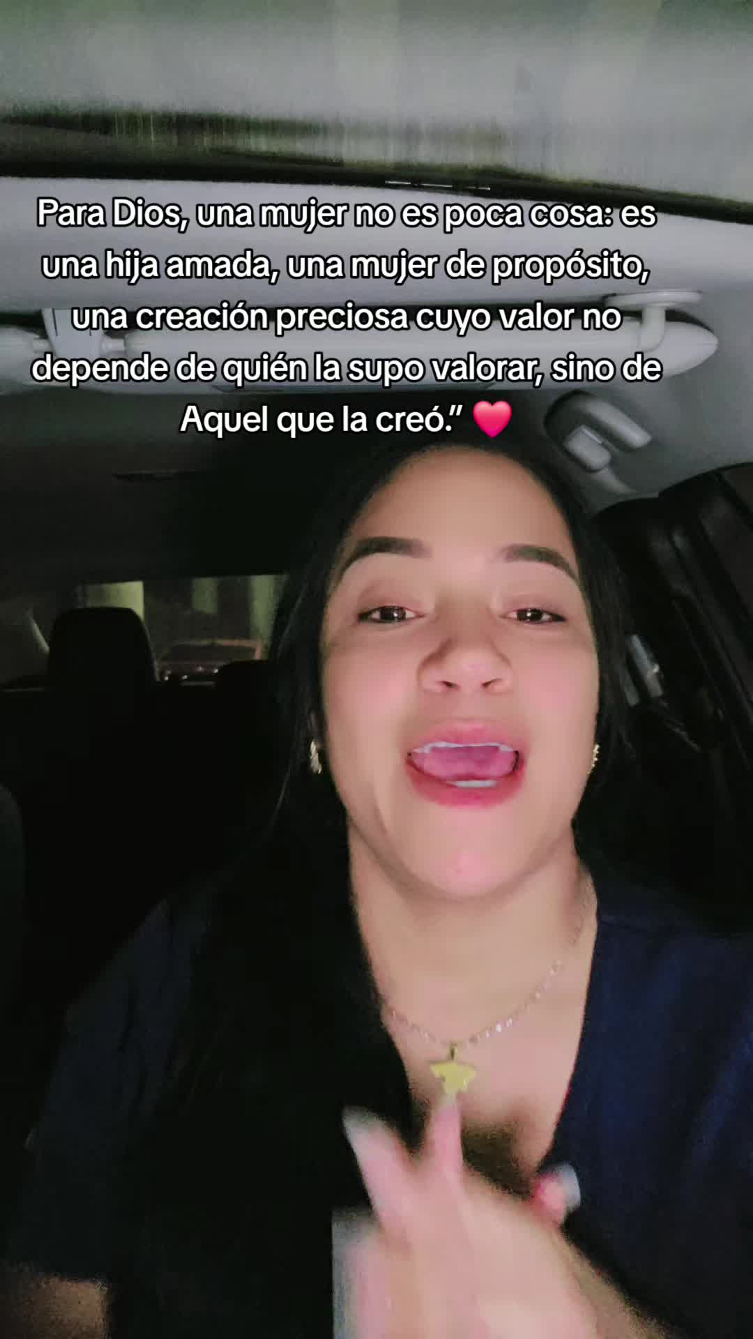 @Anabel Albarran