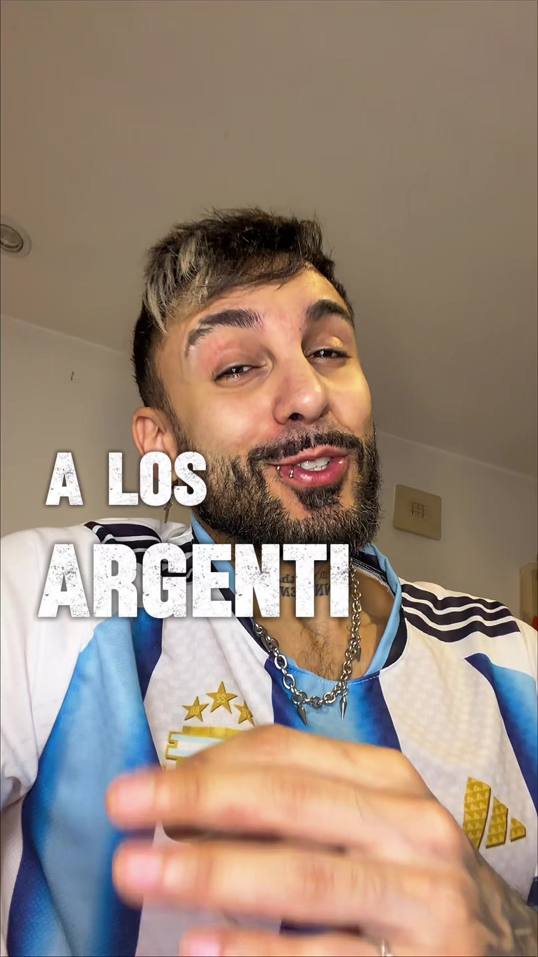 @Nacho Gonatta