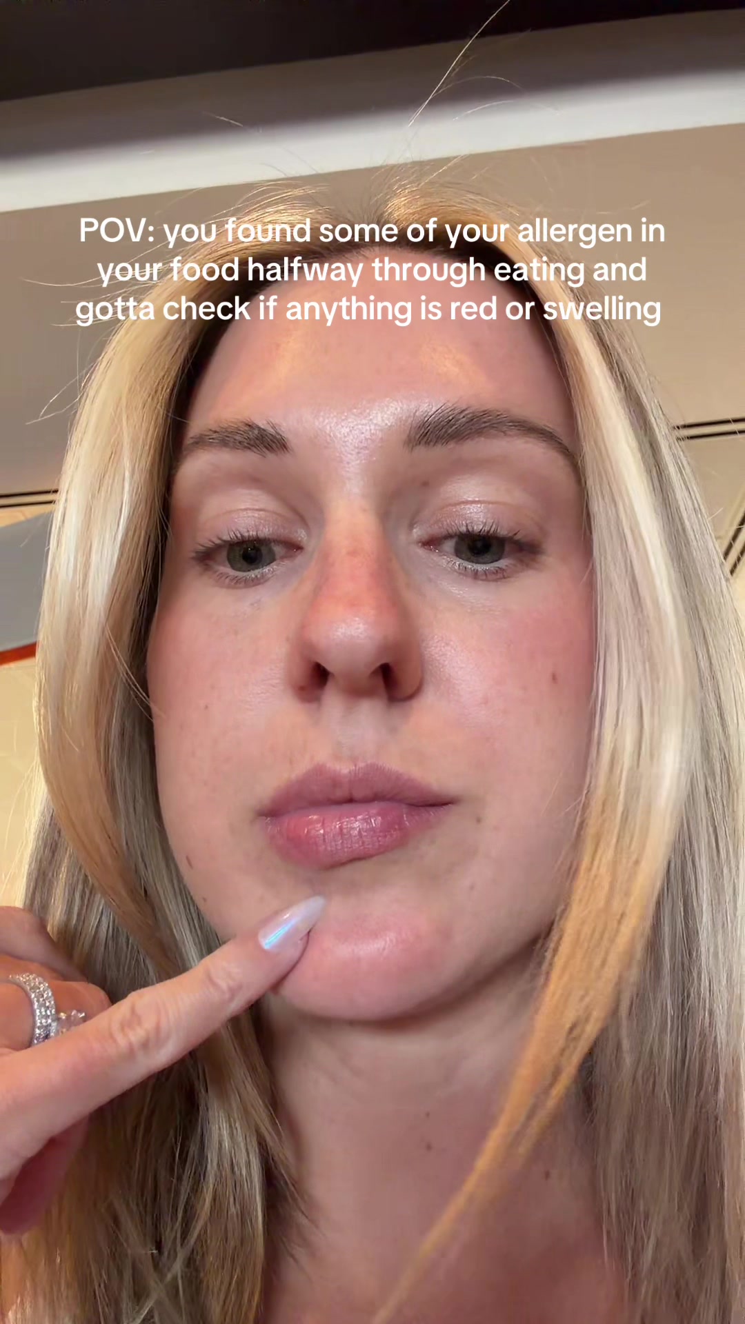 @allergygirl_