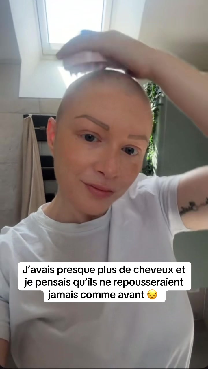 @Lux’Hair Growth