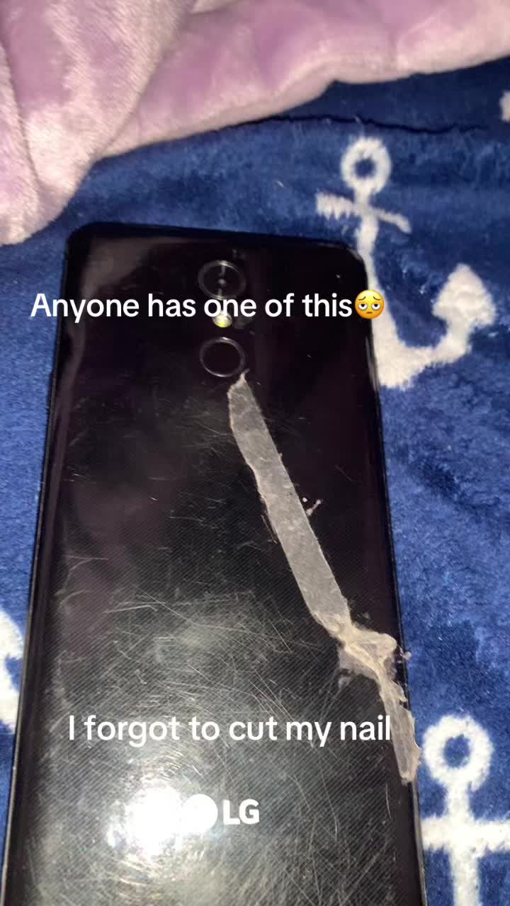 @Bruh6542