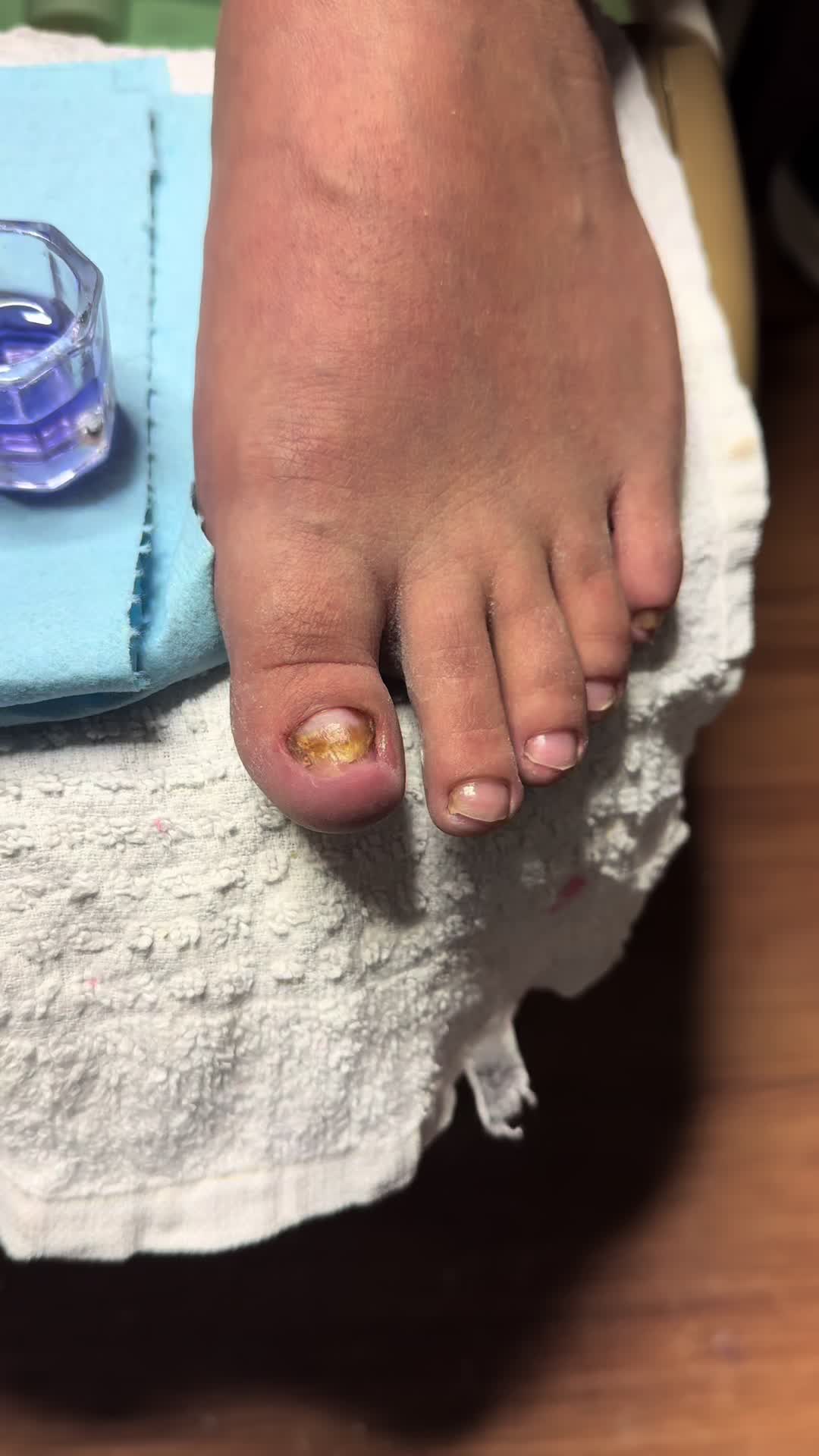 @ToesbyKoki