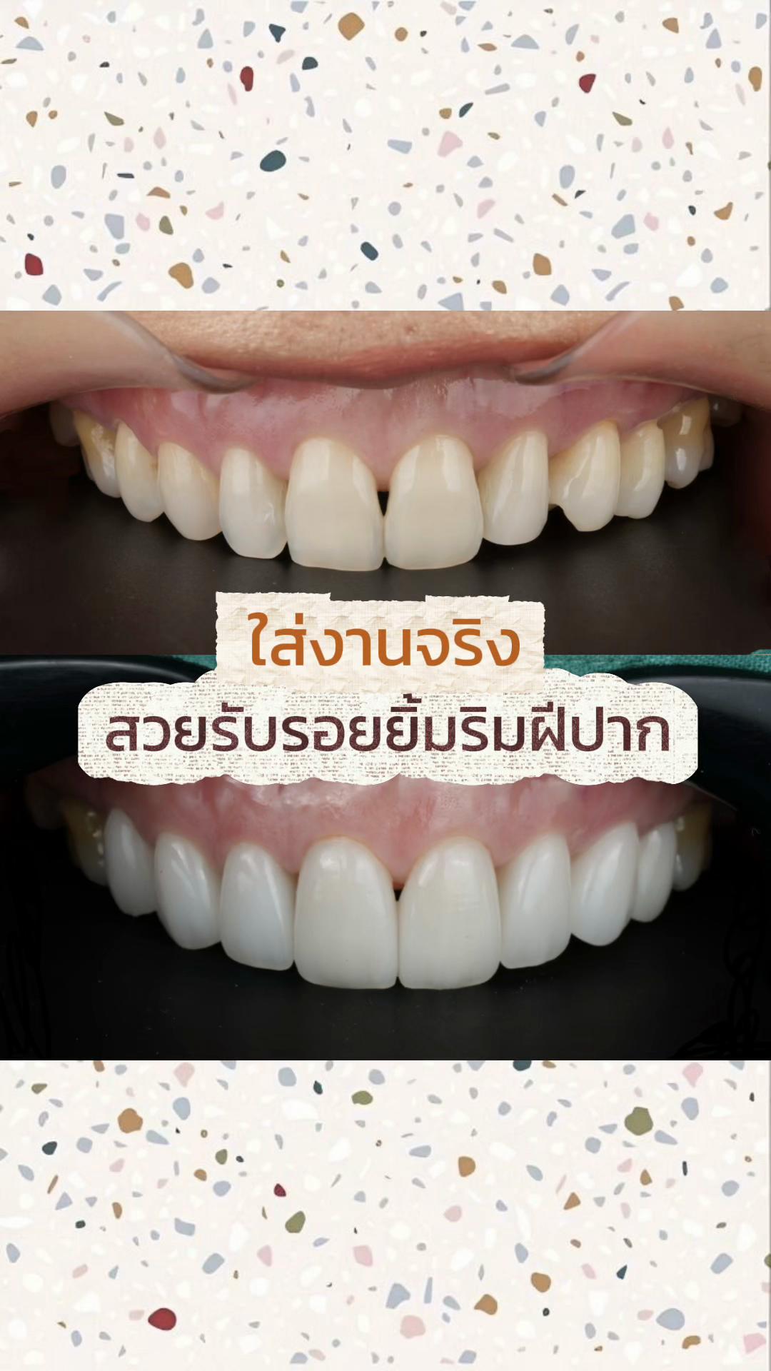 @smile Art Pattaya