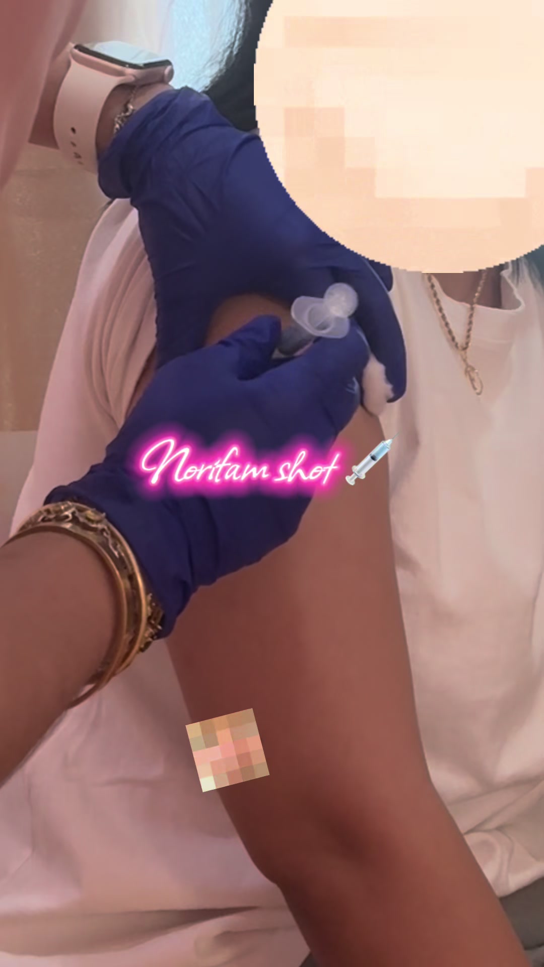 @The &Eacute;lan Aesthetics