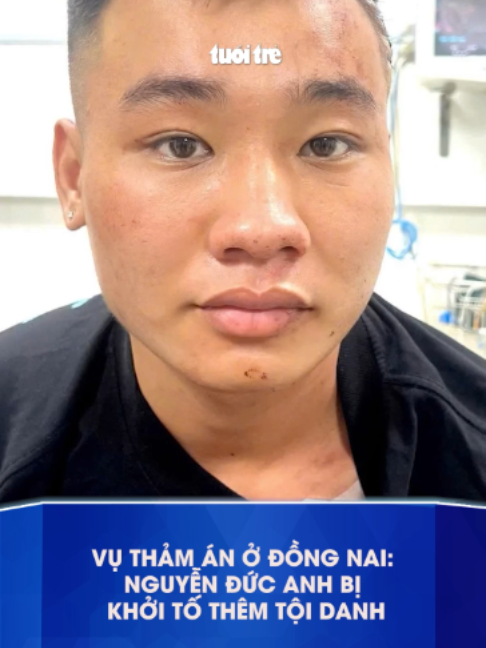 @Báo Tuổi Trẻ