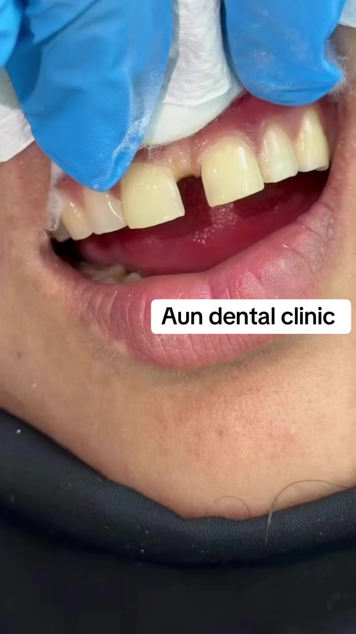 @Aun dental clinic ❤️
