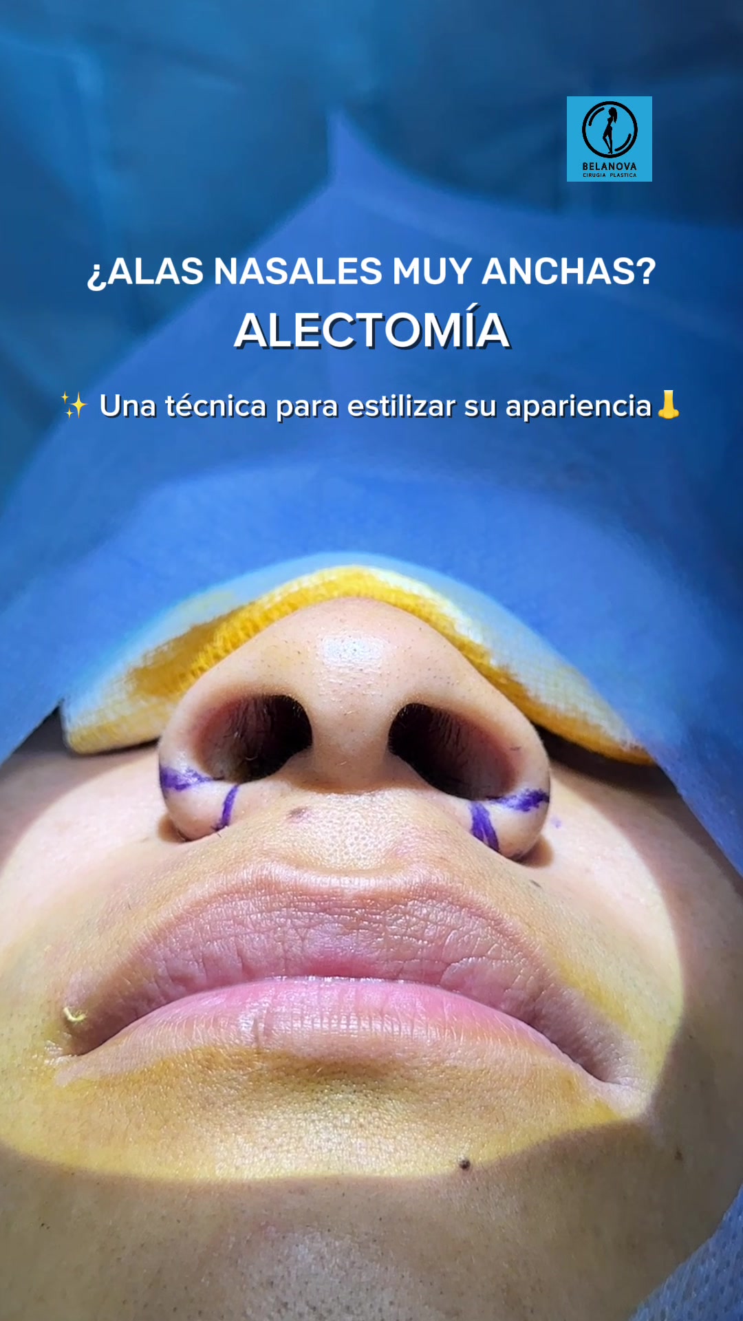 @Belanovacirugiaplastica