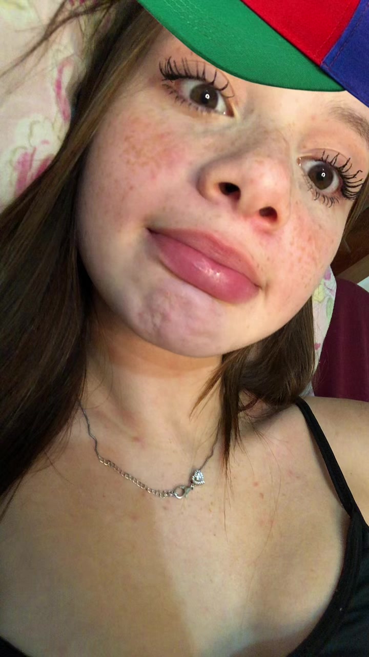 @helo molina