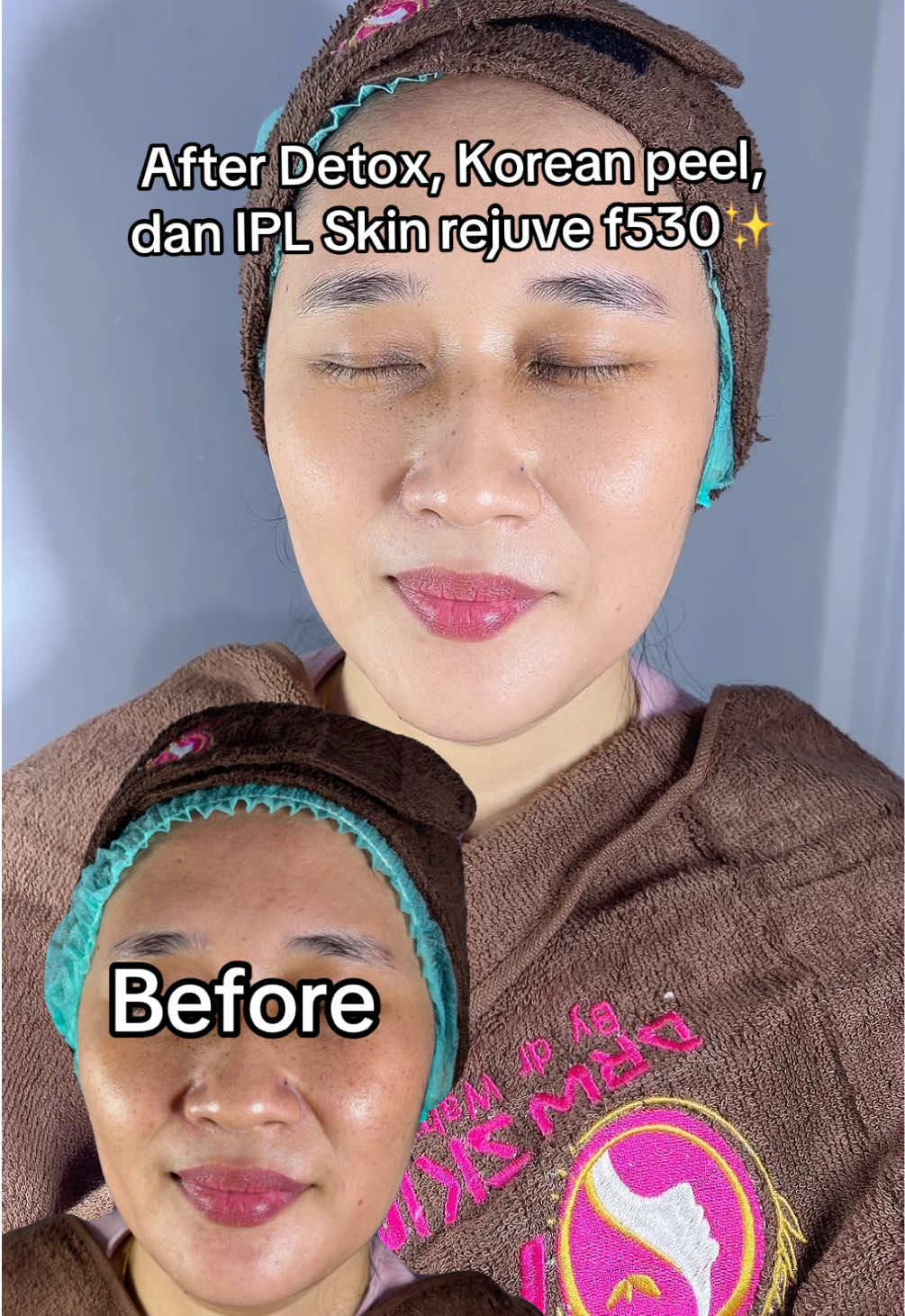 @DRW Skincare Center Pamekasan