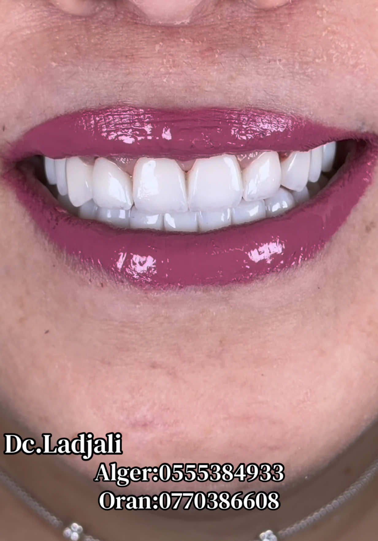 @Dr.ladjali