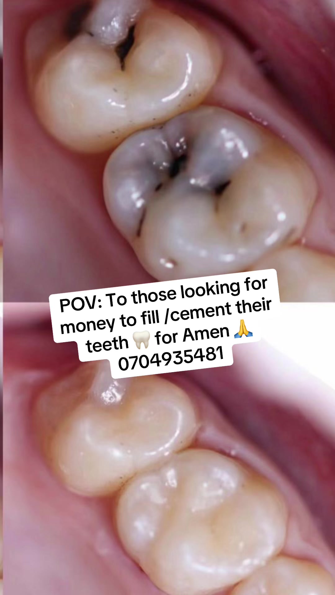 @Dentist 🦷justine226🇺🇬