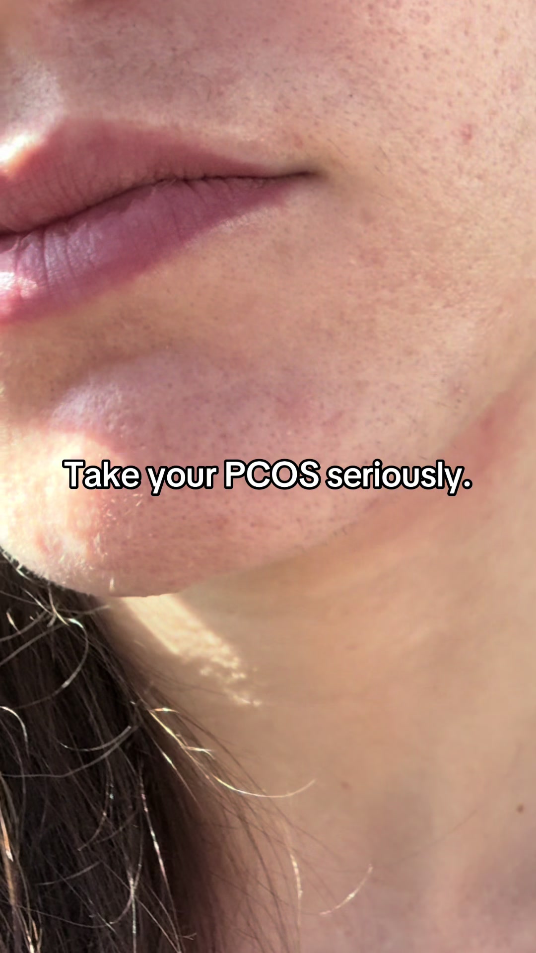 @Sarah | PMOS/PCOS life + tips