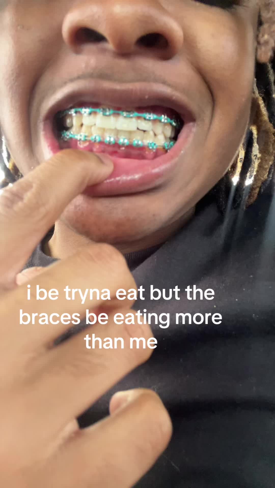@myron