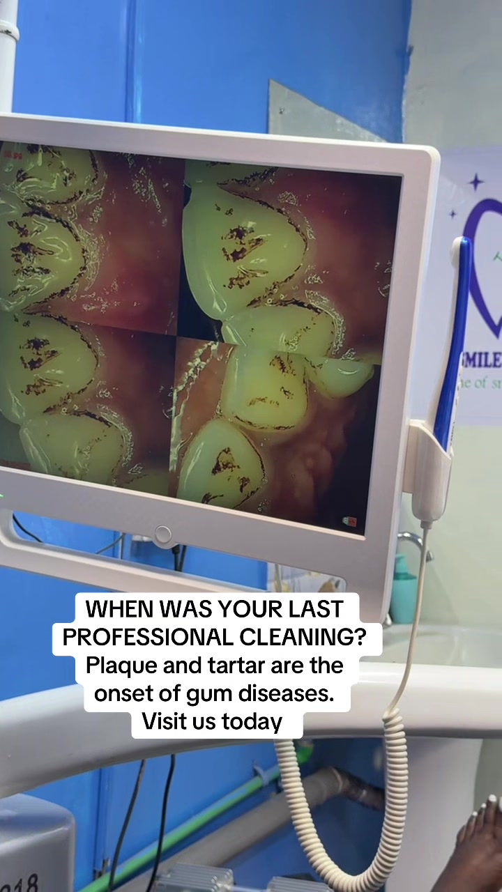 @THE SMILEY DENTAL KE