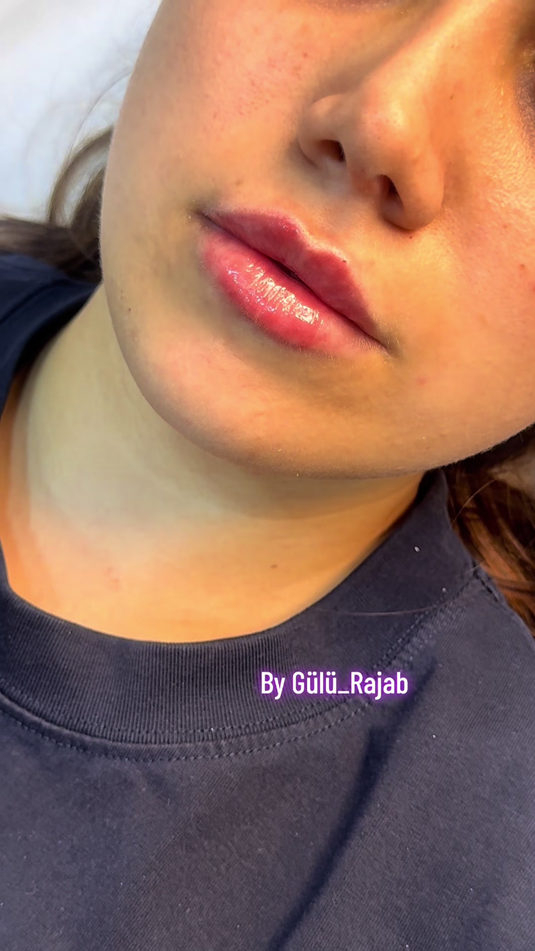 @Kosmetoloq_Gülü_Rajab