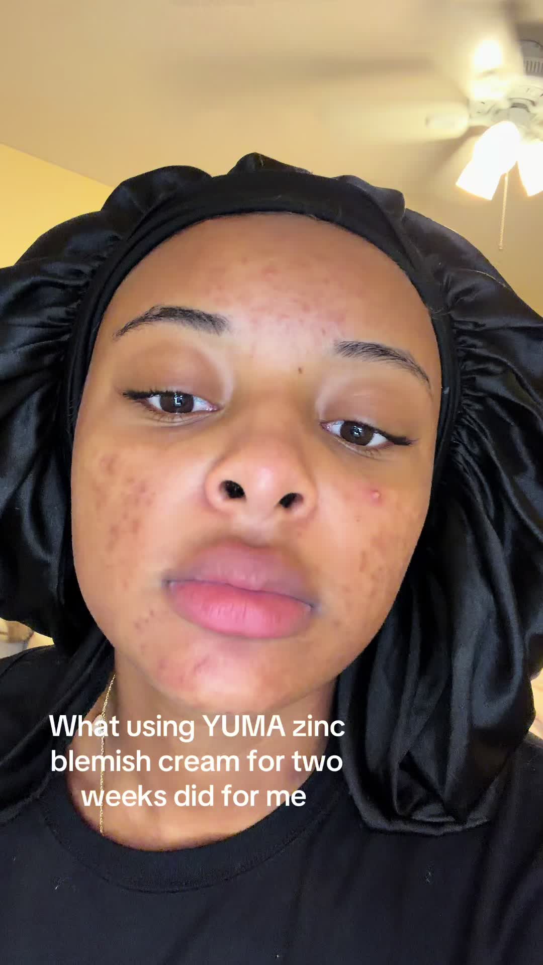 @Cheekygirlforyou