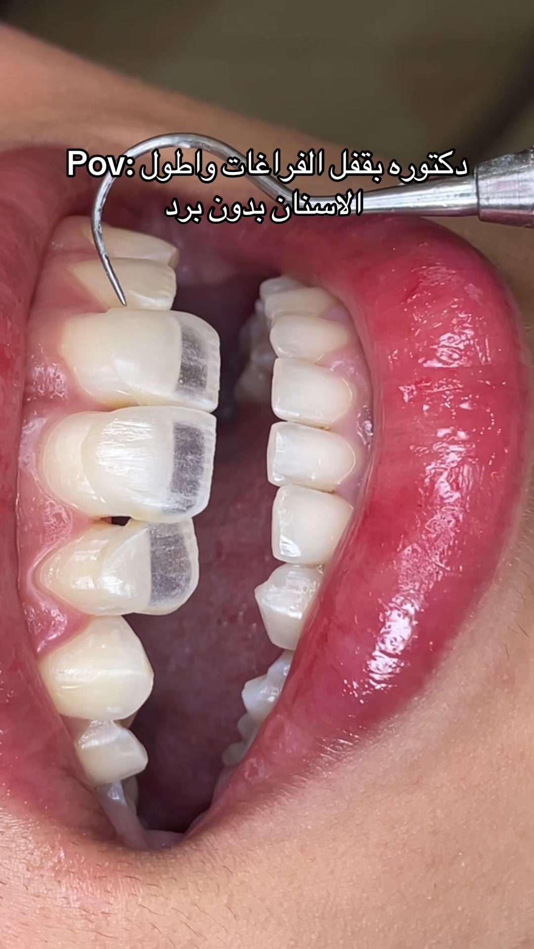 @Dr. Abrar Alhababi