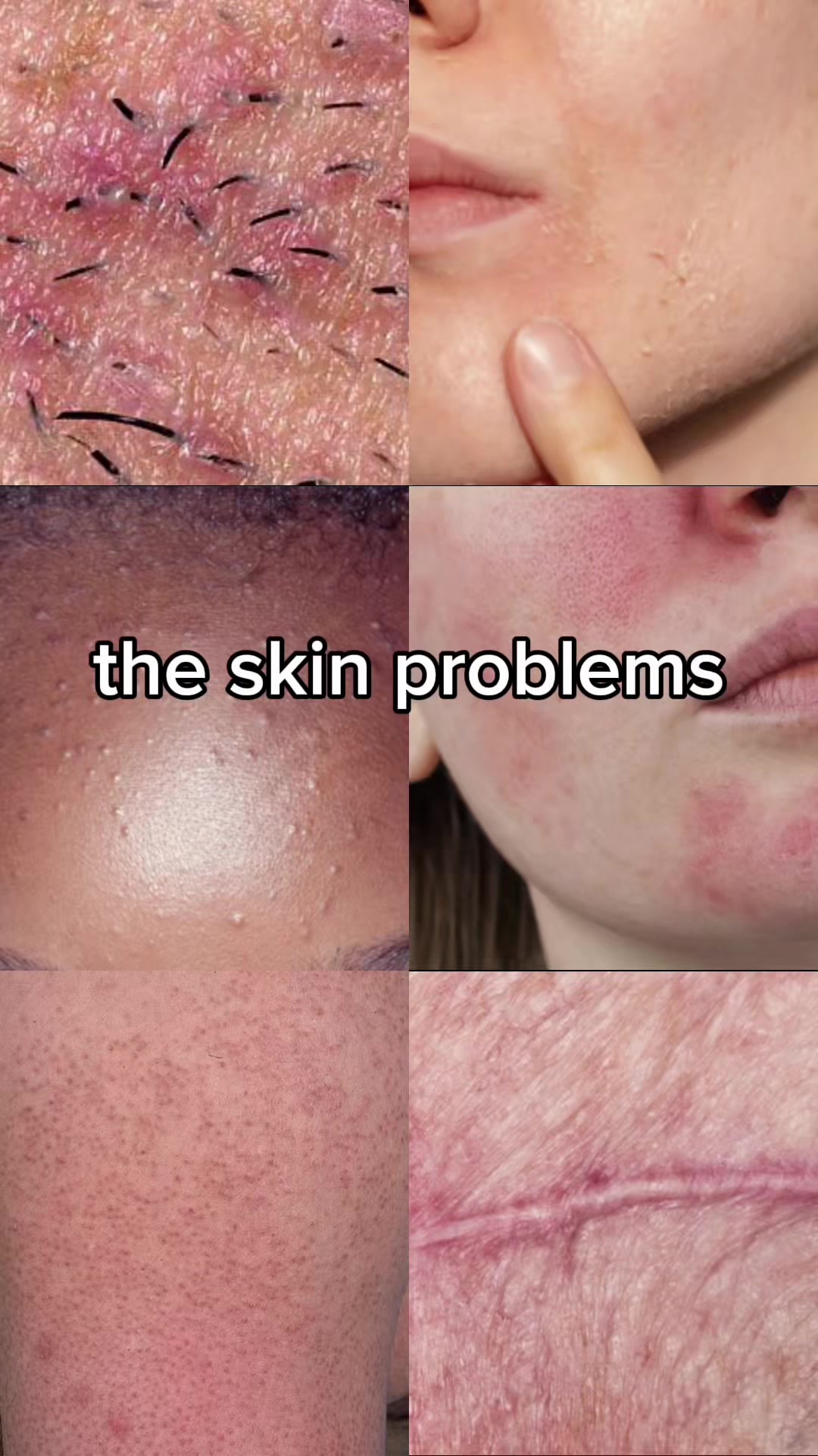 @Dr. Neera, Skin Surgeon