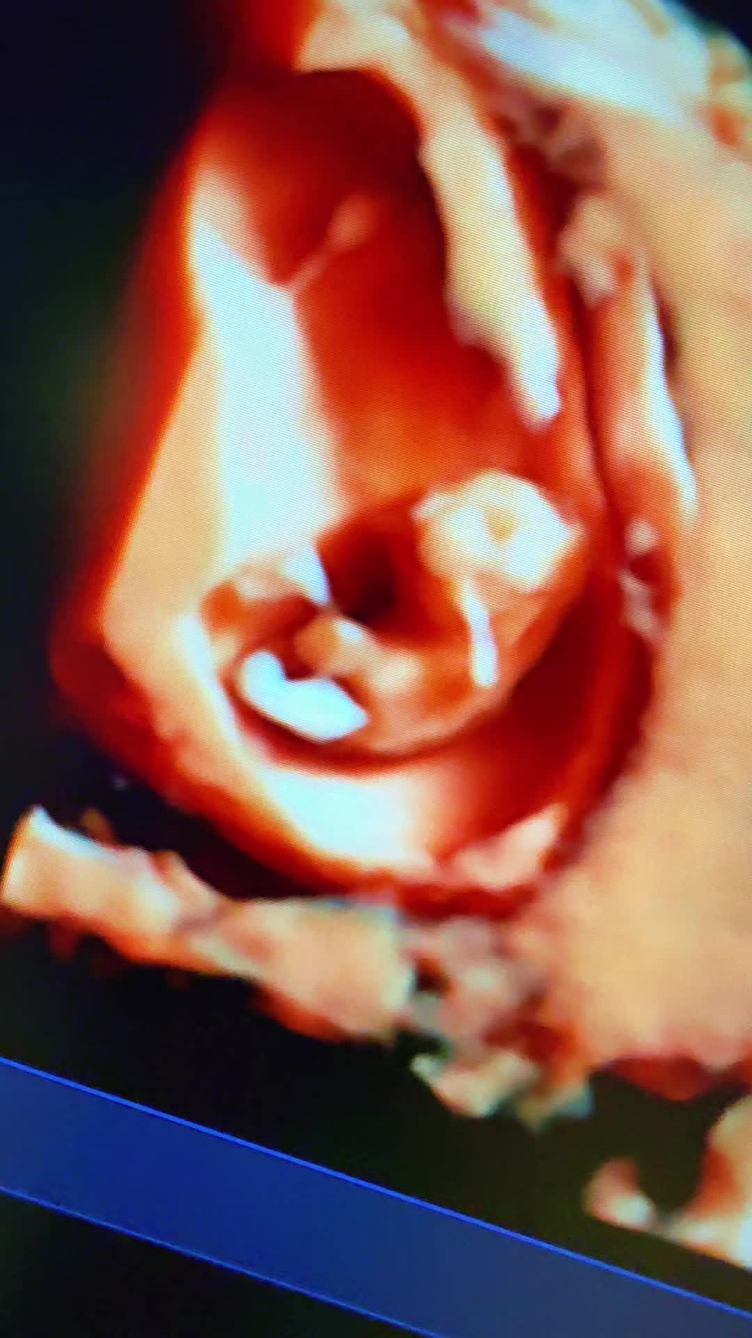 @PregnantSee Inc.