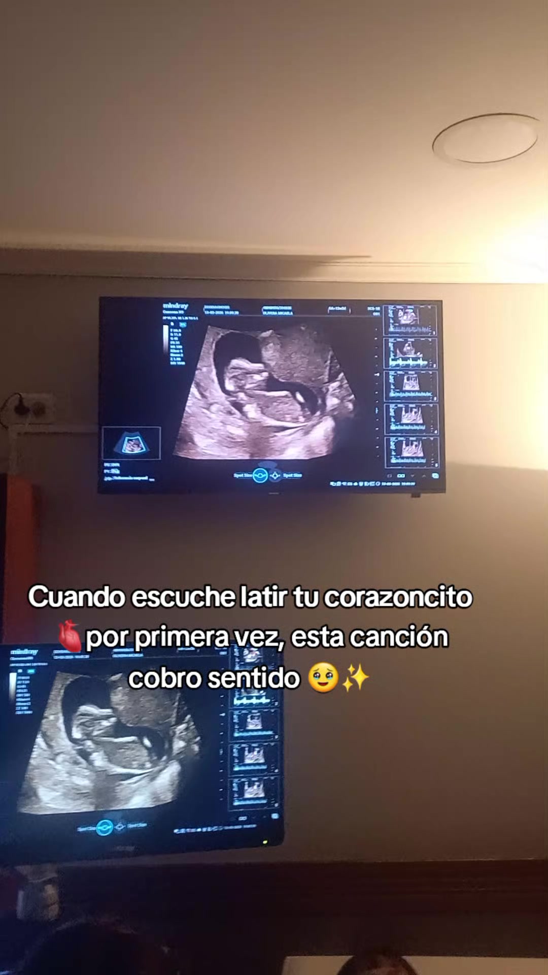 @Micaa💤
