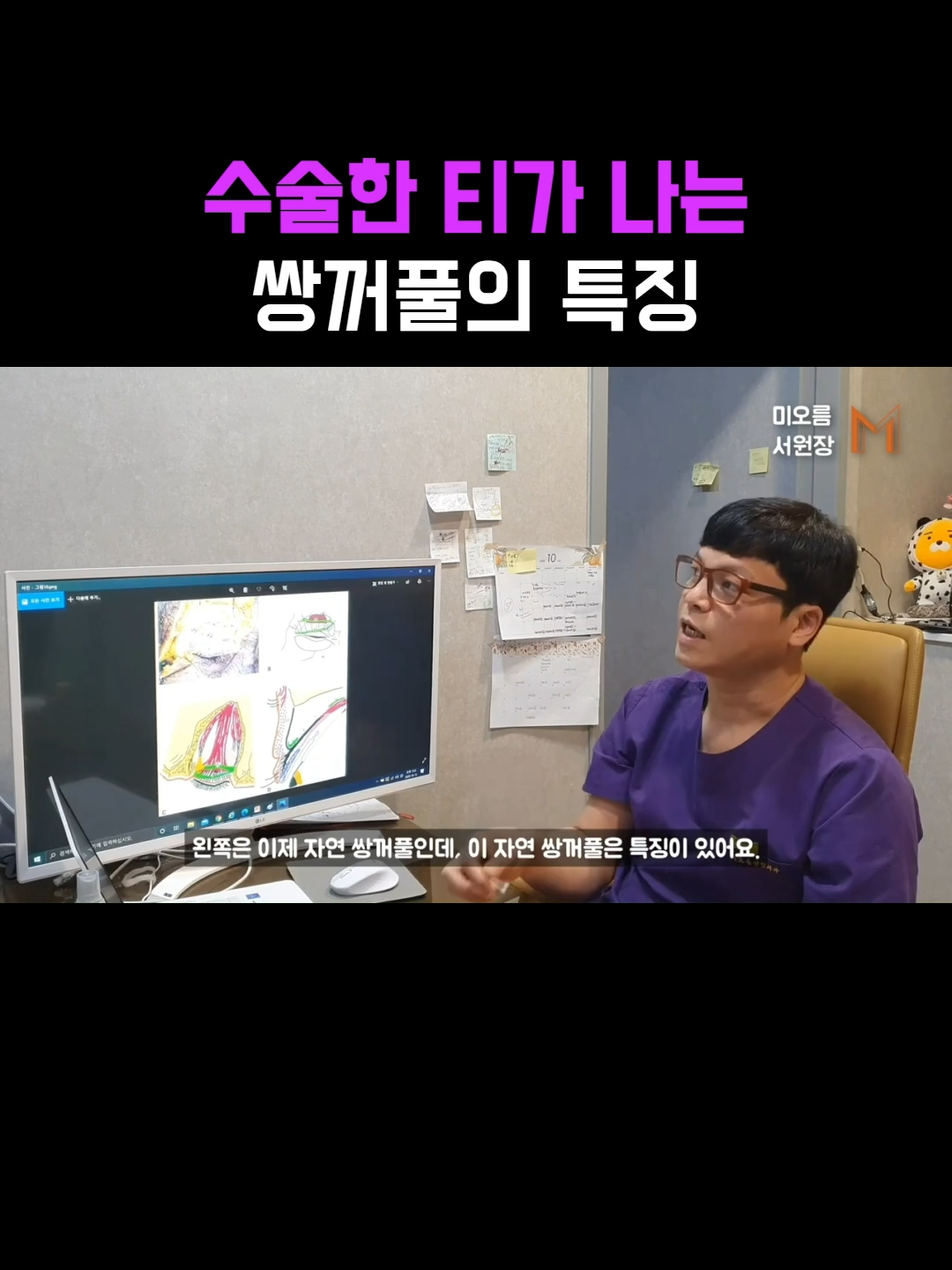 @미오름성형외과