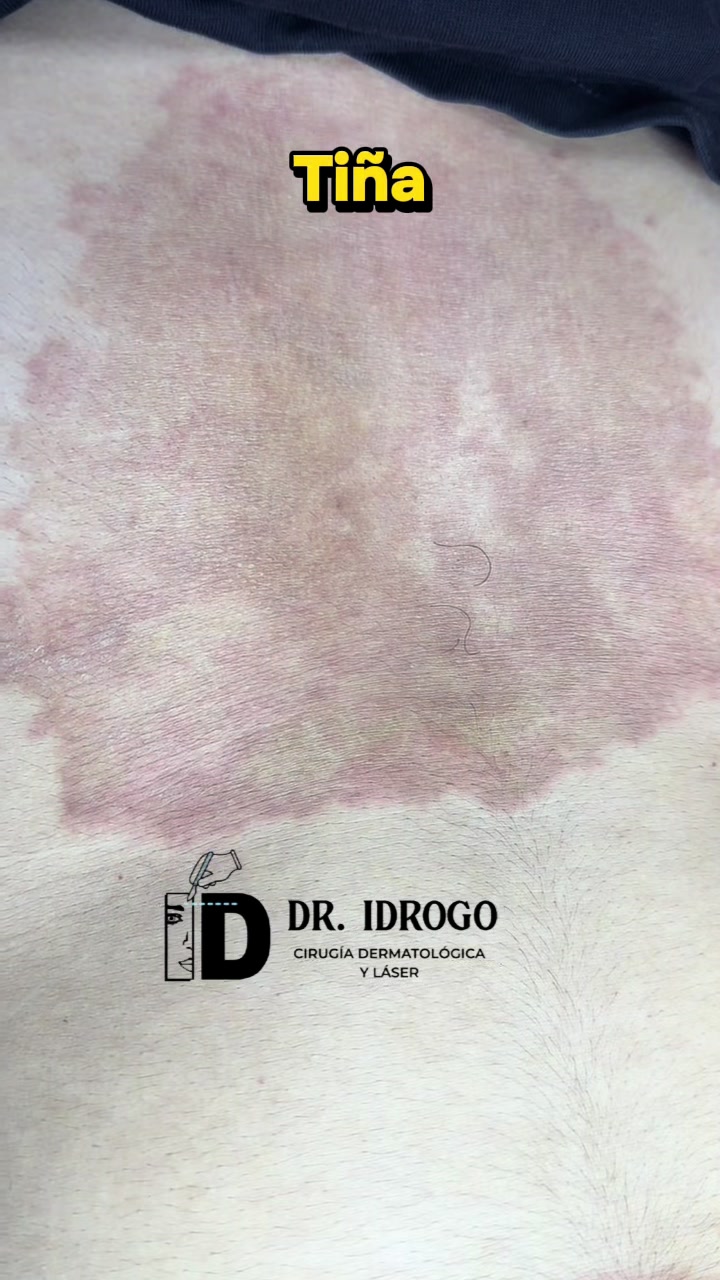 @dr.idrogodermatologo