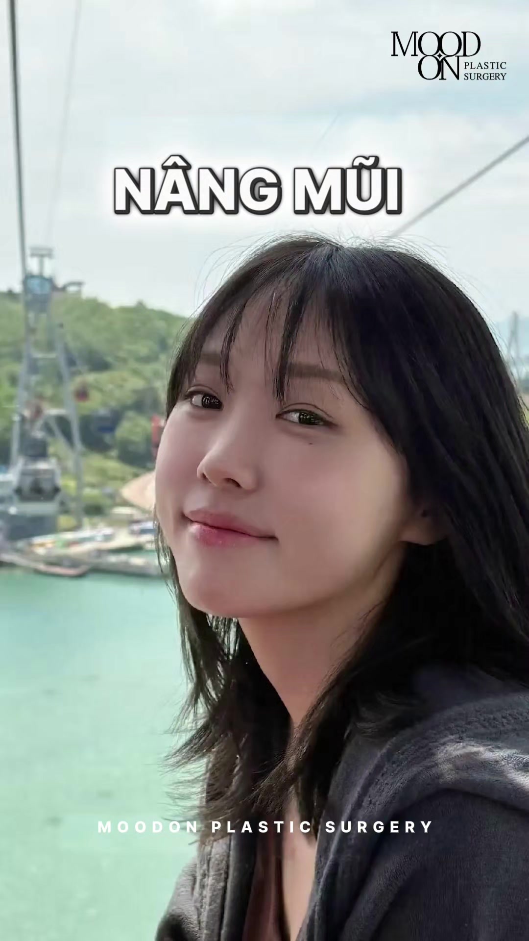 @Bệnh viện thẩm mỹ Mood On