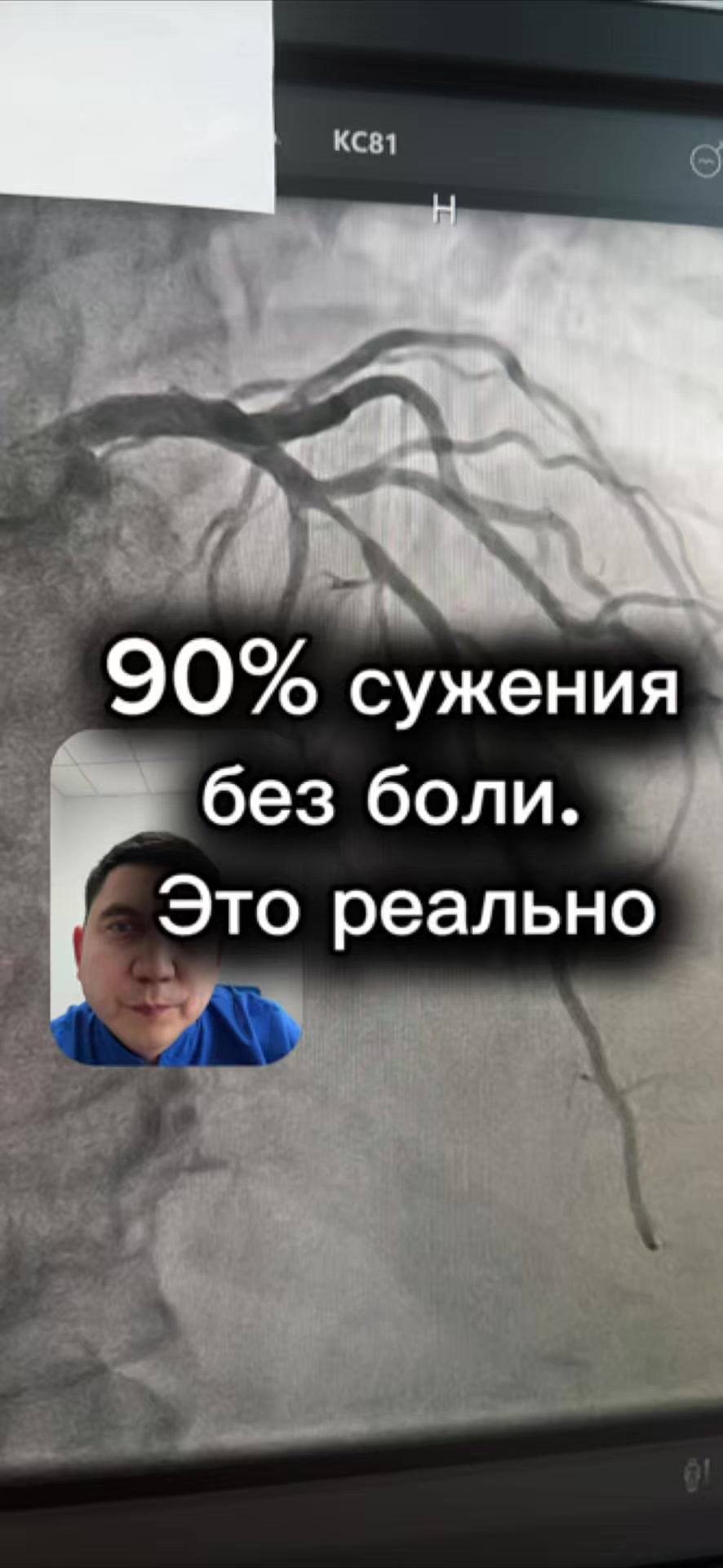 @Кардиолог / Аспет