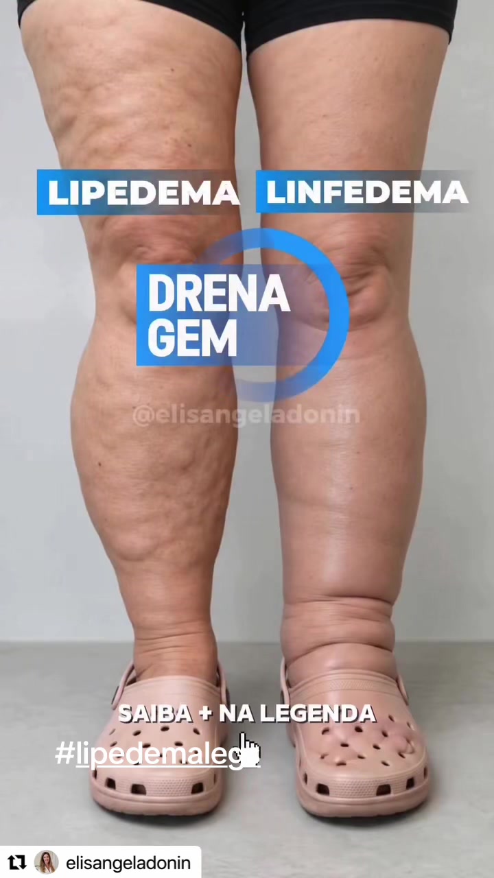 @Paola Morales