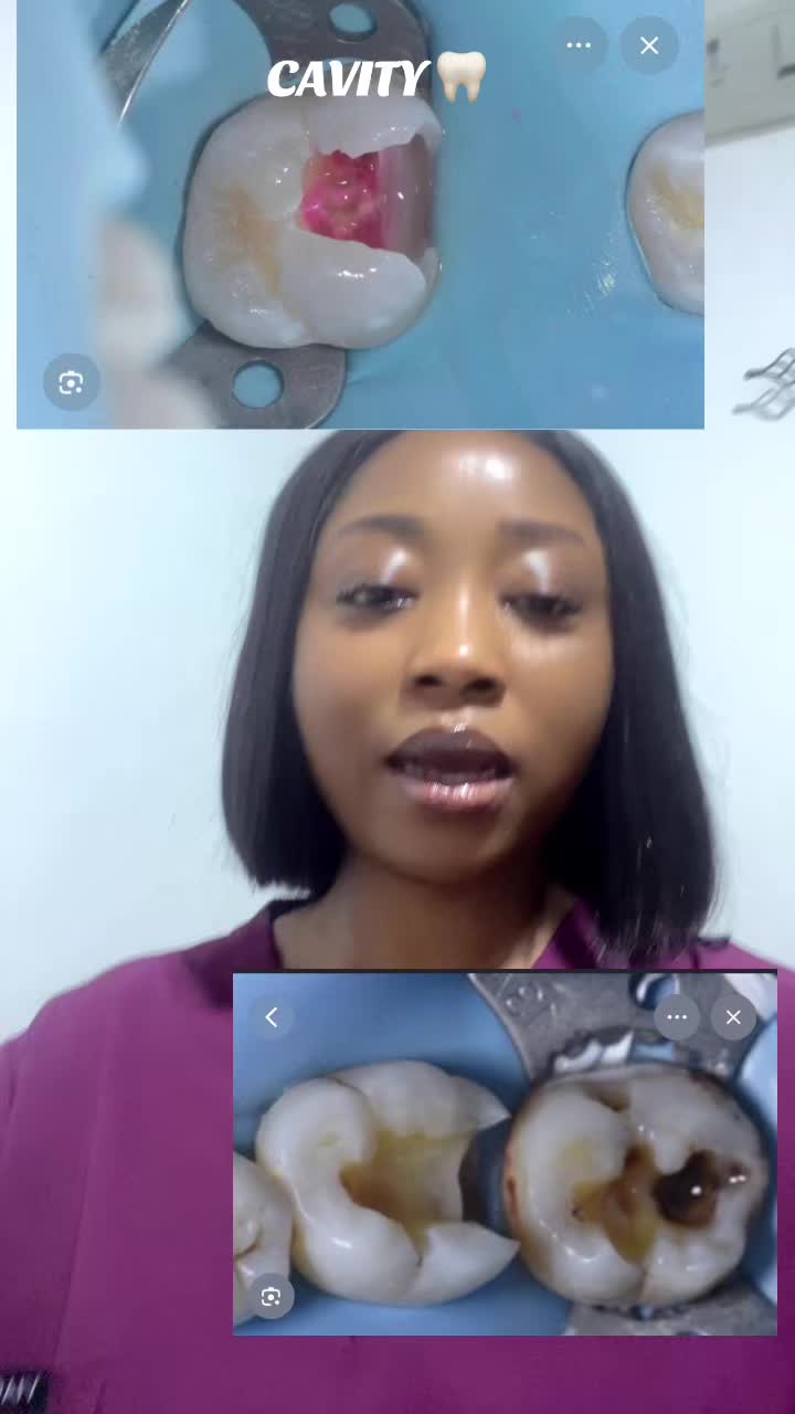 @NurseVivinelle_OralEducator🦷