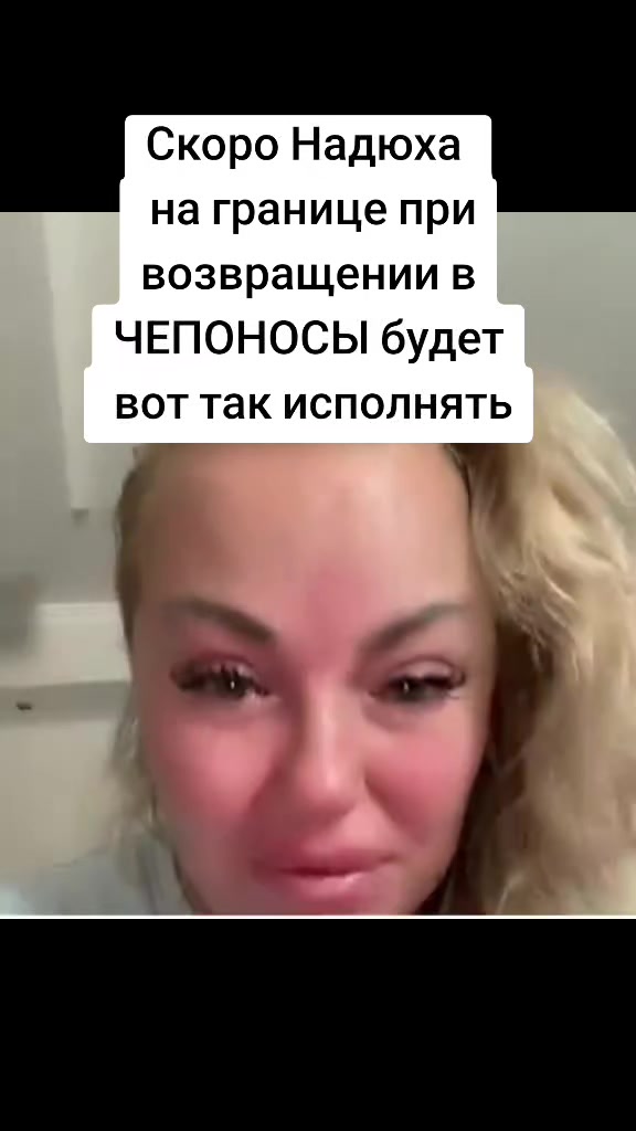 @ЧЕПОНОСИХА