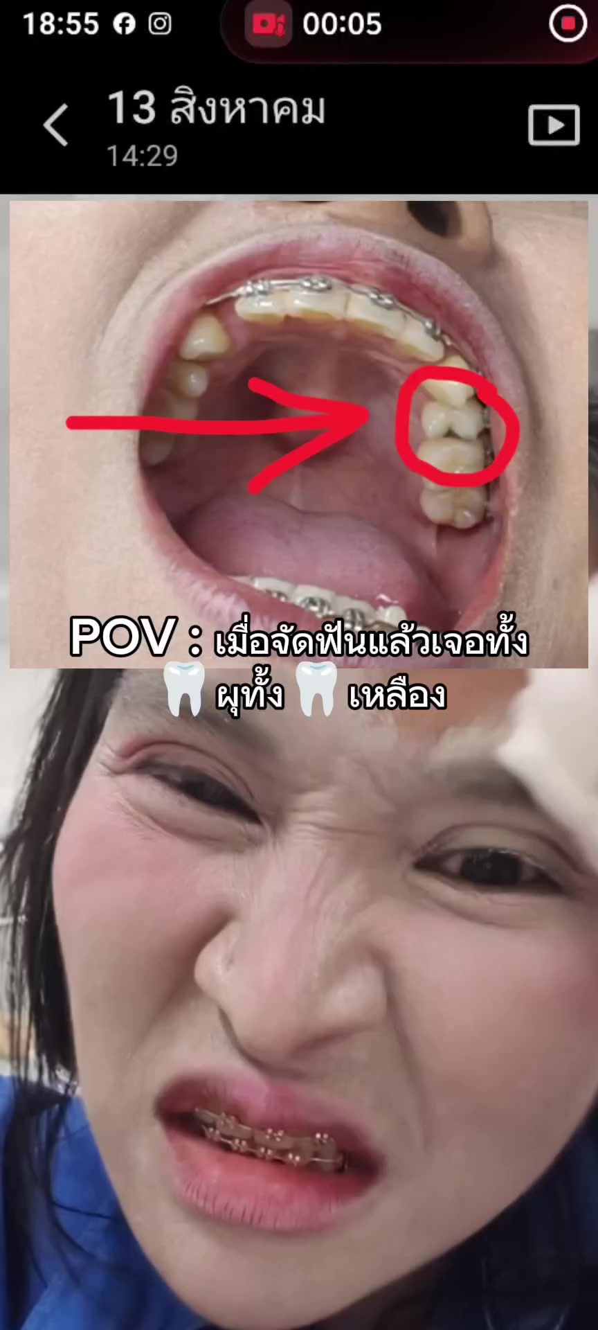 @จารย์เมอิ๊ง