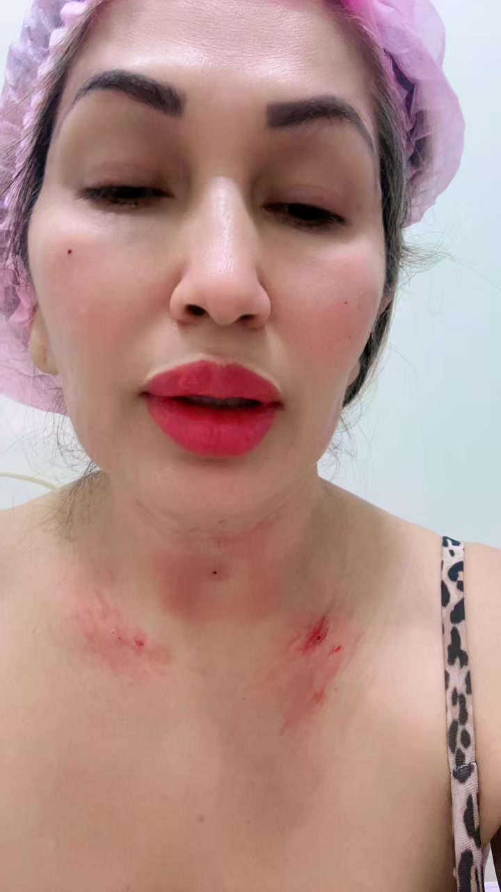 @Ana